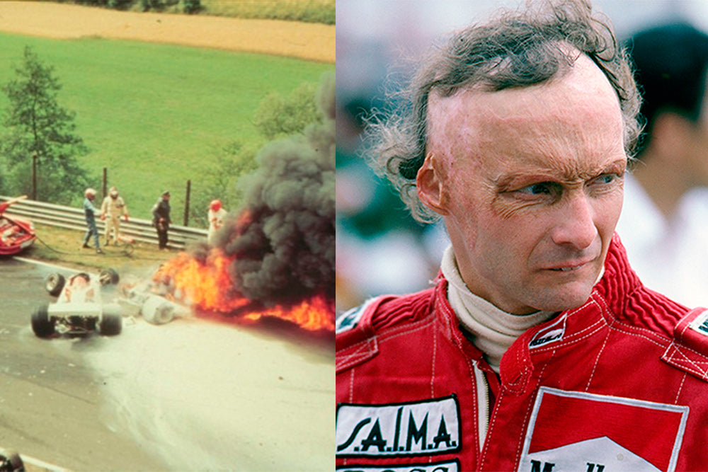 Bombshell: Niki Lauda Explains Why his Life was Change After the Auto Crash that….